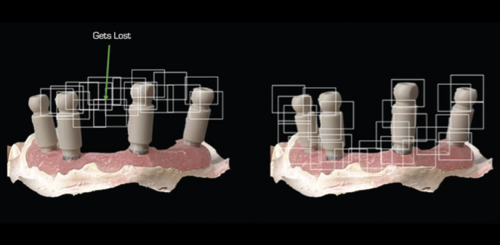 Z-Effect in Scan Bodies