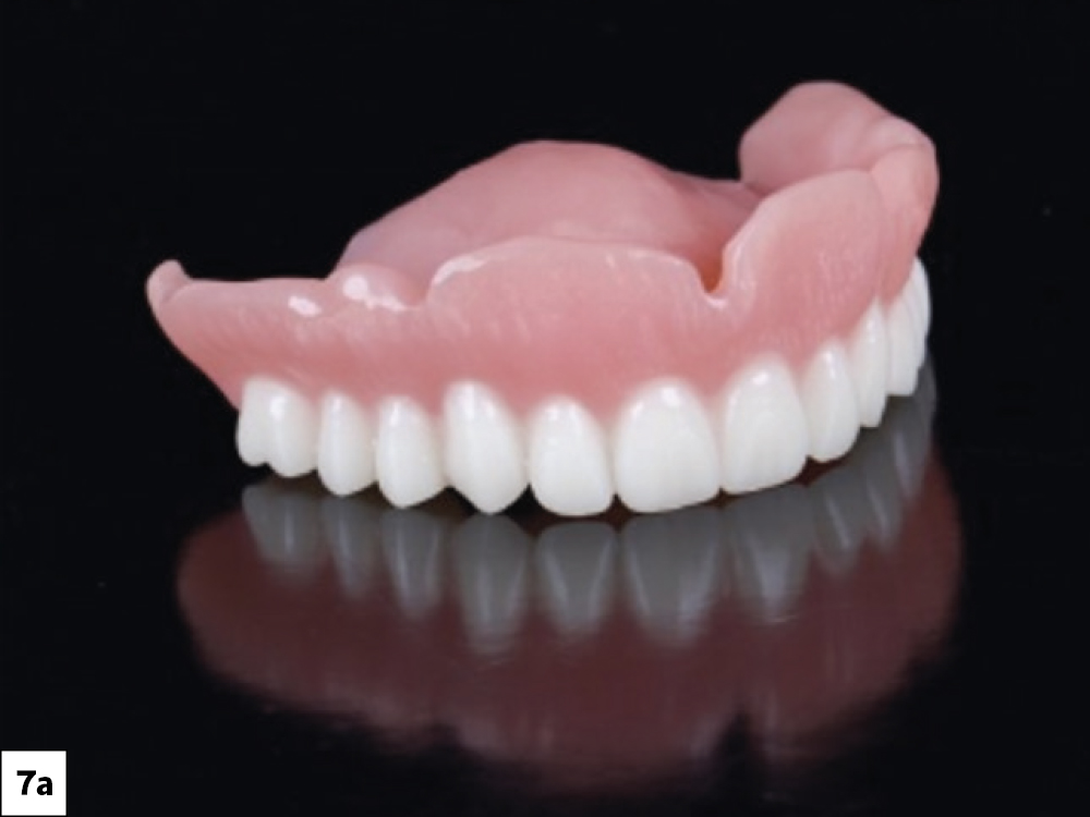 The completed 3D-printed definitive Simply Natural™ Digital Dentures from Glidewell were fabricated using a proprietary base and teeth resin.