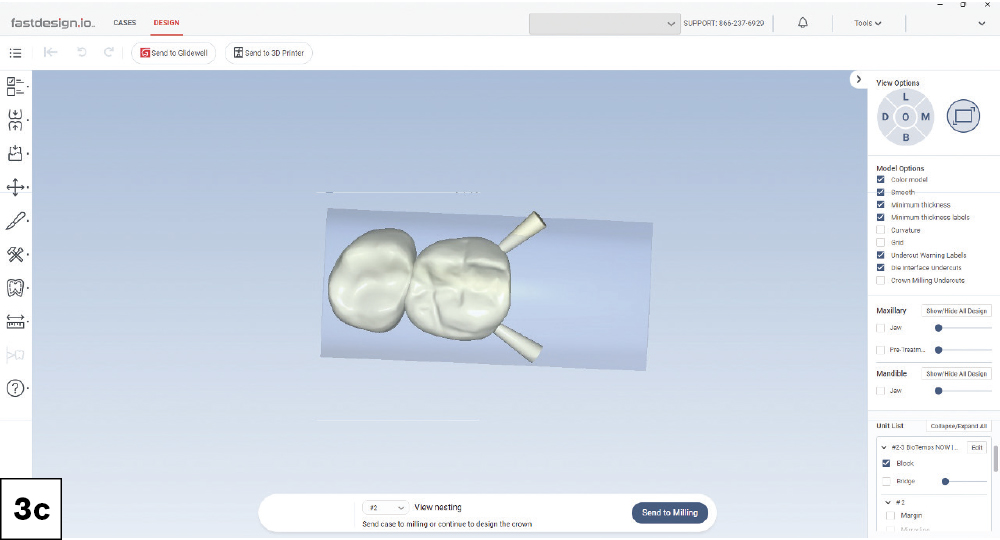 3D nesting view of two provisional crown designs positioned in a milling block within fastdesign.io.