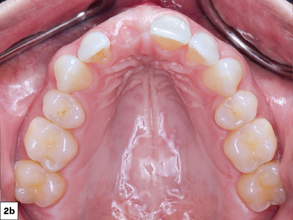 eliciting the uninhibited Duchenne smile