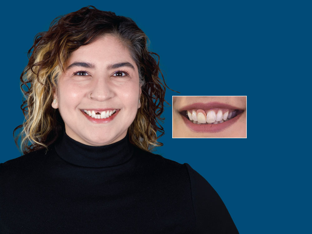 Helping a Self-Conscious Patient Regain Her Smile