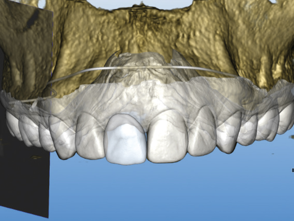 Combined, digital records enabled the design of a diagnostic prosthesis