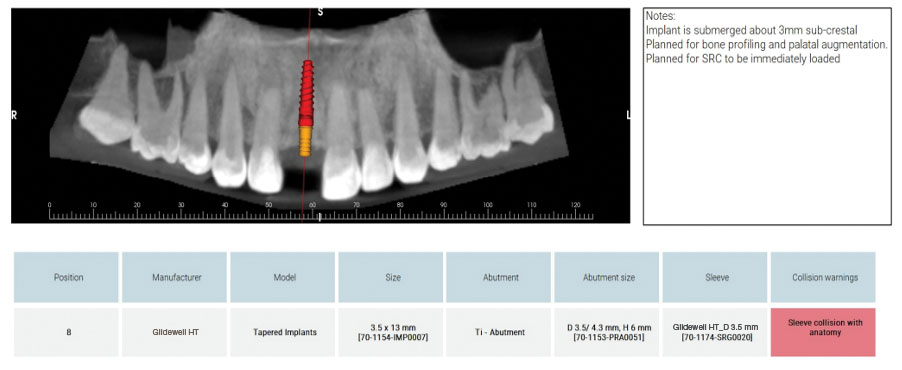 This service provides significant value by coordinating both the surgical and restorative aspects of care
