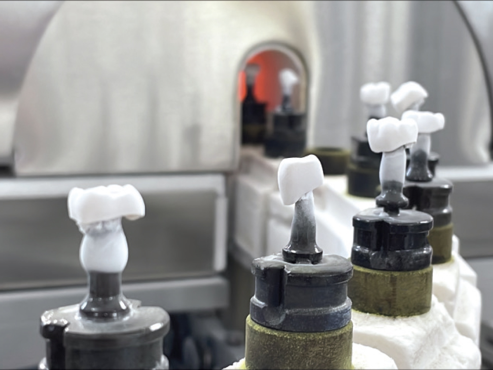 Increases in case volume and increasingly complex restorative designs led to bottlenecks between digital design and physical production