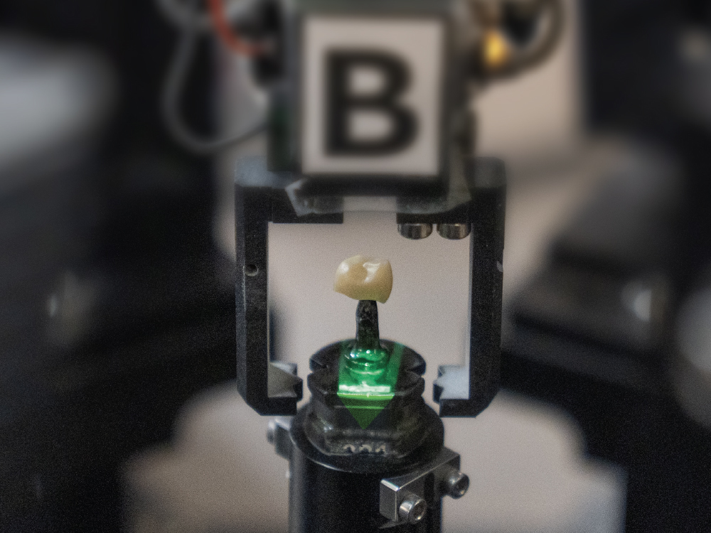  AI-assisted software then automatically generates a design, beginning with a virtual model process including die trim, cleanup, and margin marking