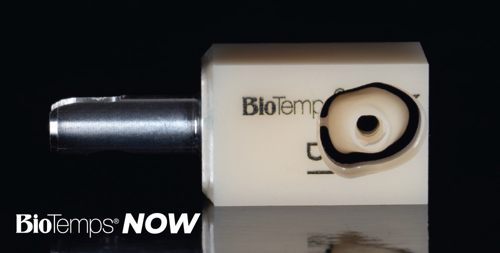 The BioTemps NOW SRC is designed to simplify the delivery of milled temporary screw-retained crowns while allowing practices to continue working with the implant systems they already rely on