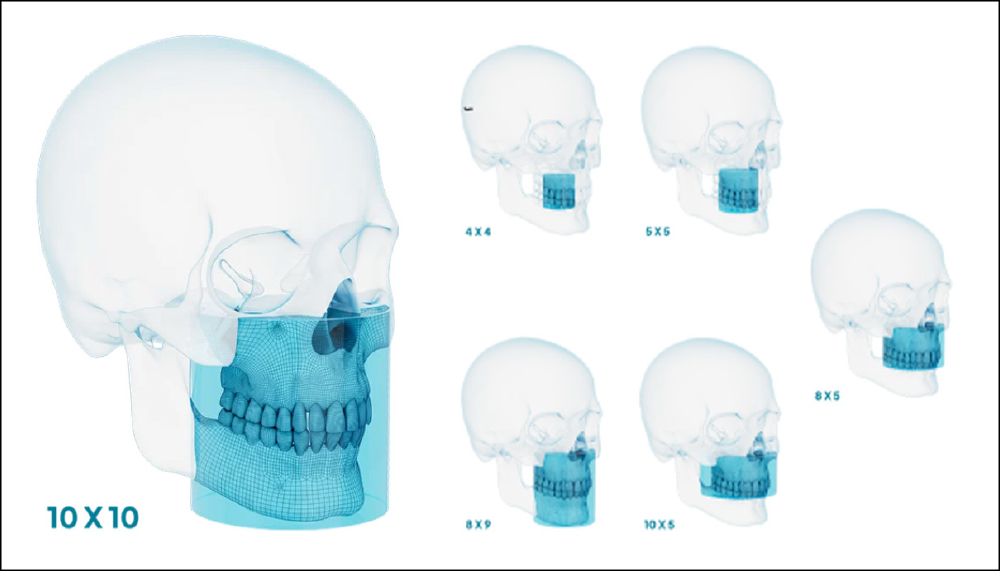 Diagram comparing six CBCT fields of view on skull illustrations, ranging from 4x4 to 10x10, for the CS 8200 3D Access.