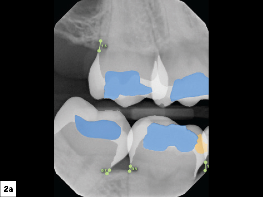 The X-ray was taken two years prior to consultation