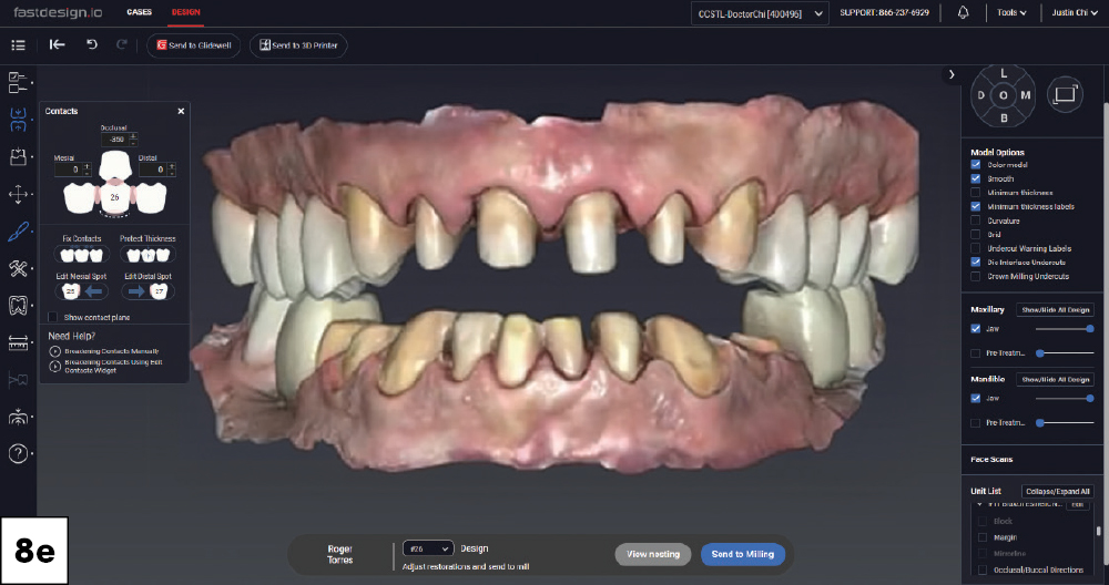 Both arches displayed open in fastdesign.io showing full-mouth crown and veneer designs, facial view.
