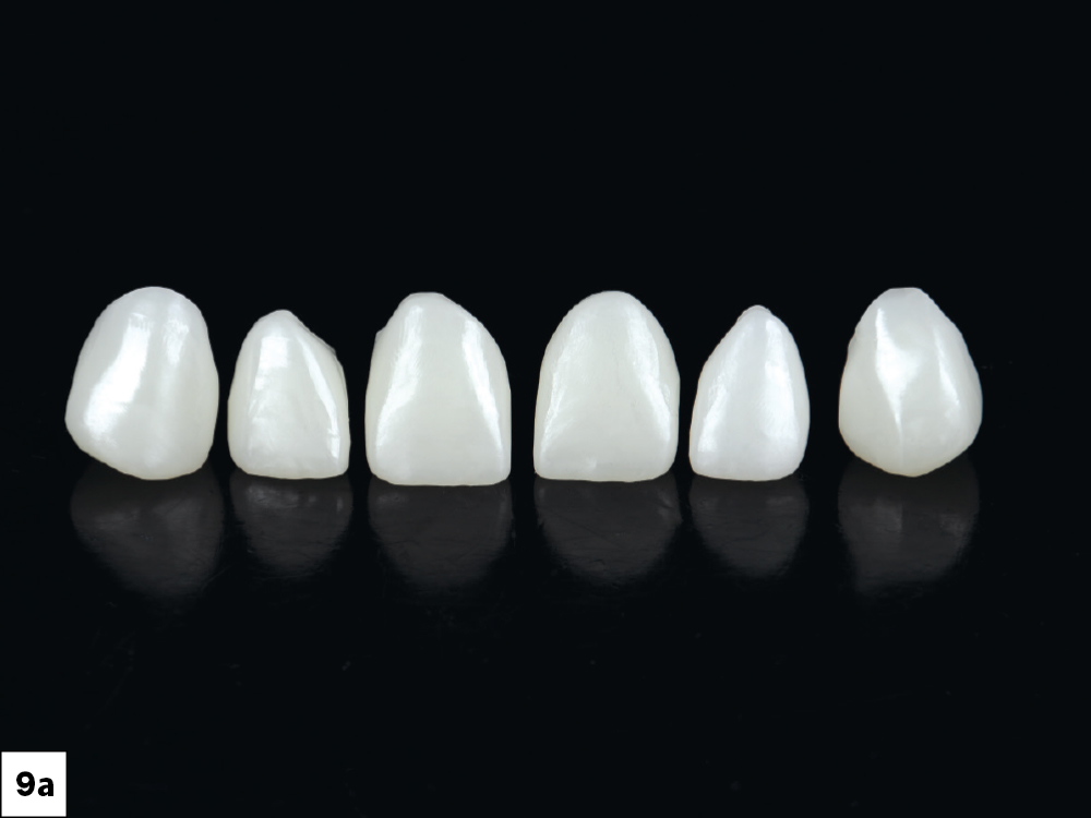 Six milled BruxZir Esthetic anterior crowns displayed in a row against a black background.