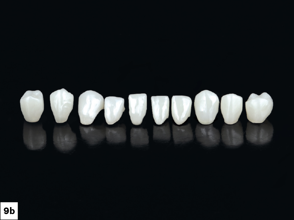 Ten milled BruxZir Esthetic crowns, veneers, and endocrowns displayed in a row against a black background.