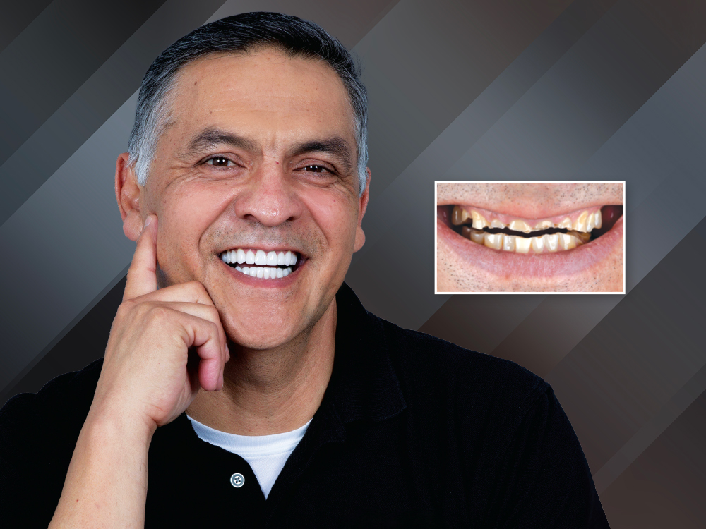 Predictability by Design: A Full-Mouth Makeover