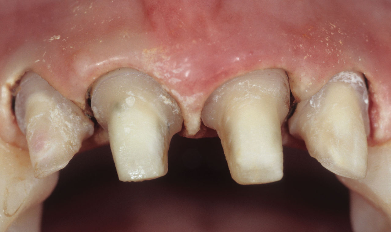 Clinical Techniques in Prosthodontics main image