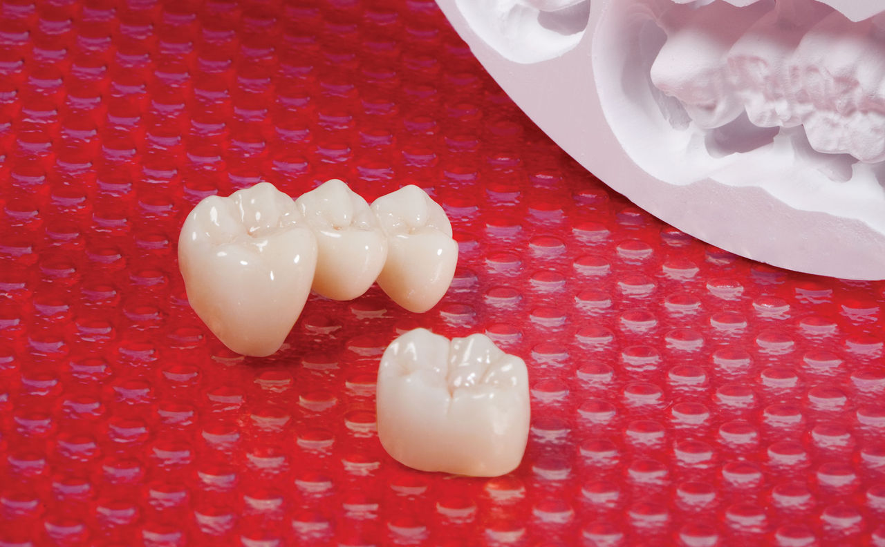 Dr. DiTolla’s Clinical Tips – BruxZir Total Zirconia