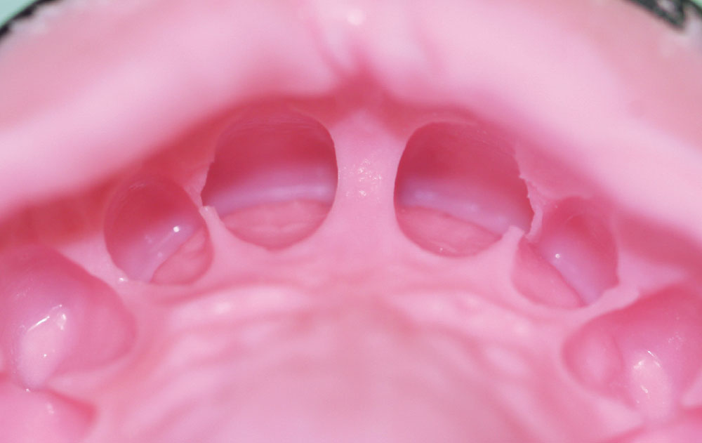 Alginate Substitutes Rationale for Their Use