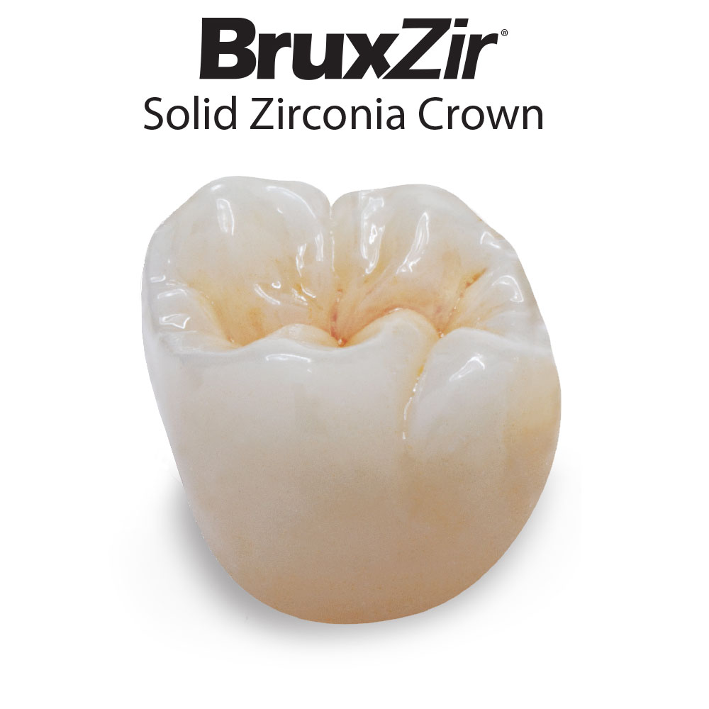 BruxZir Solid Zirconia crown
