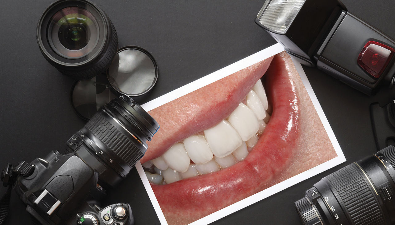 Dental Photography: A New Perspective