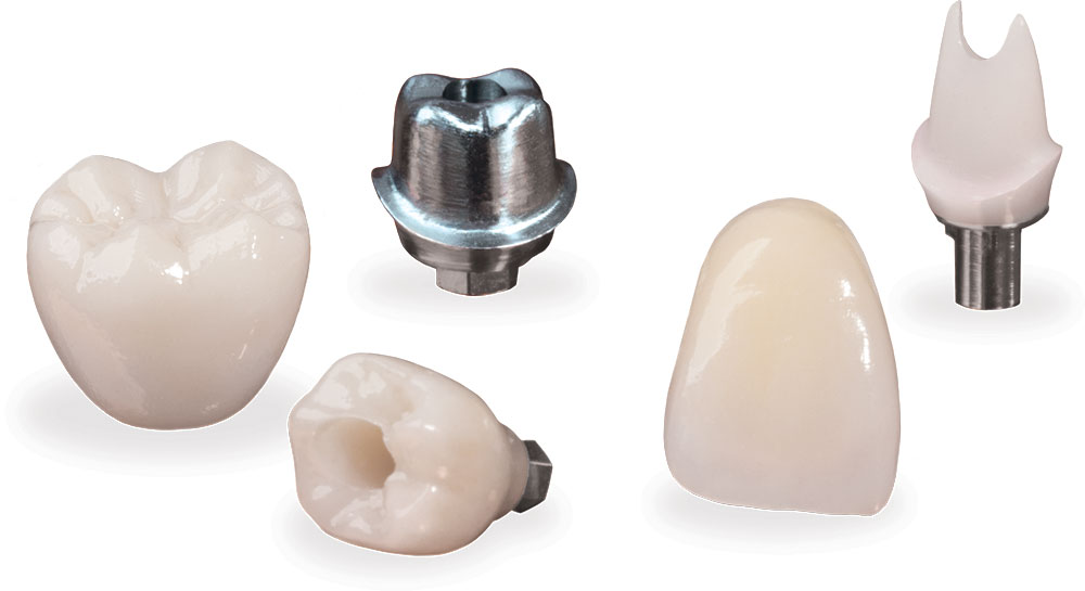 A collection of implant restorations