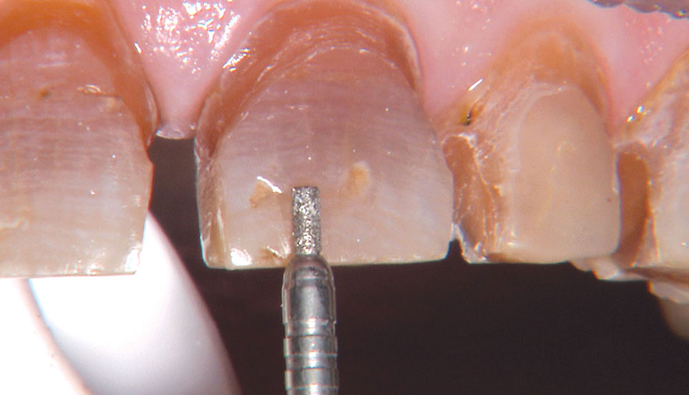 Figure 18