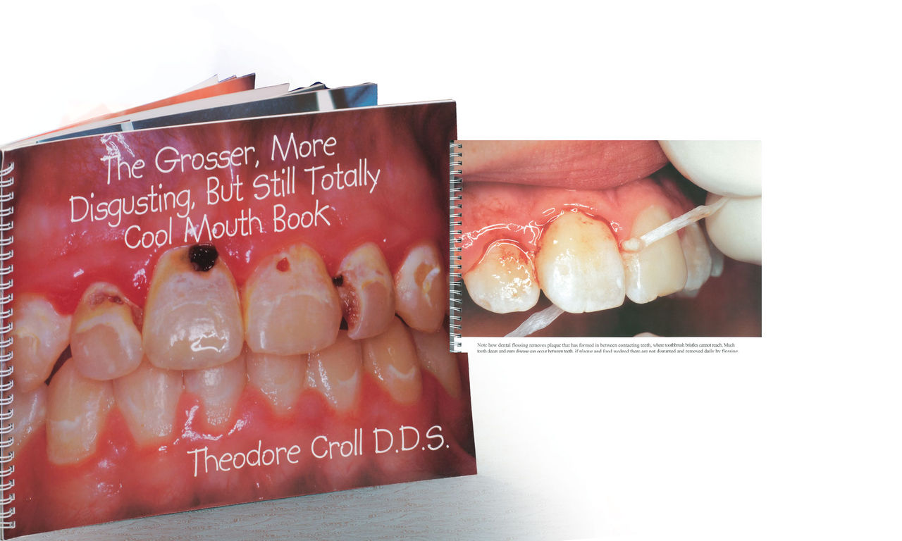 “The Grosser, More Disgusting, But Still Totally Cool Mouth Book” by Theodore Croll, DDS