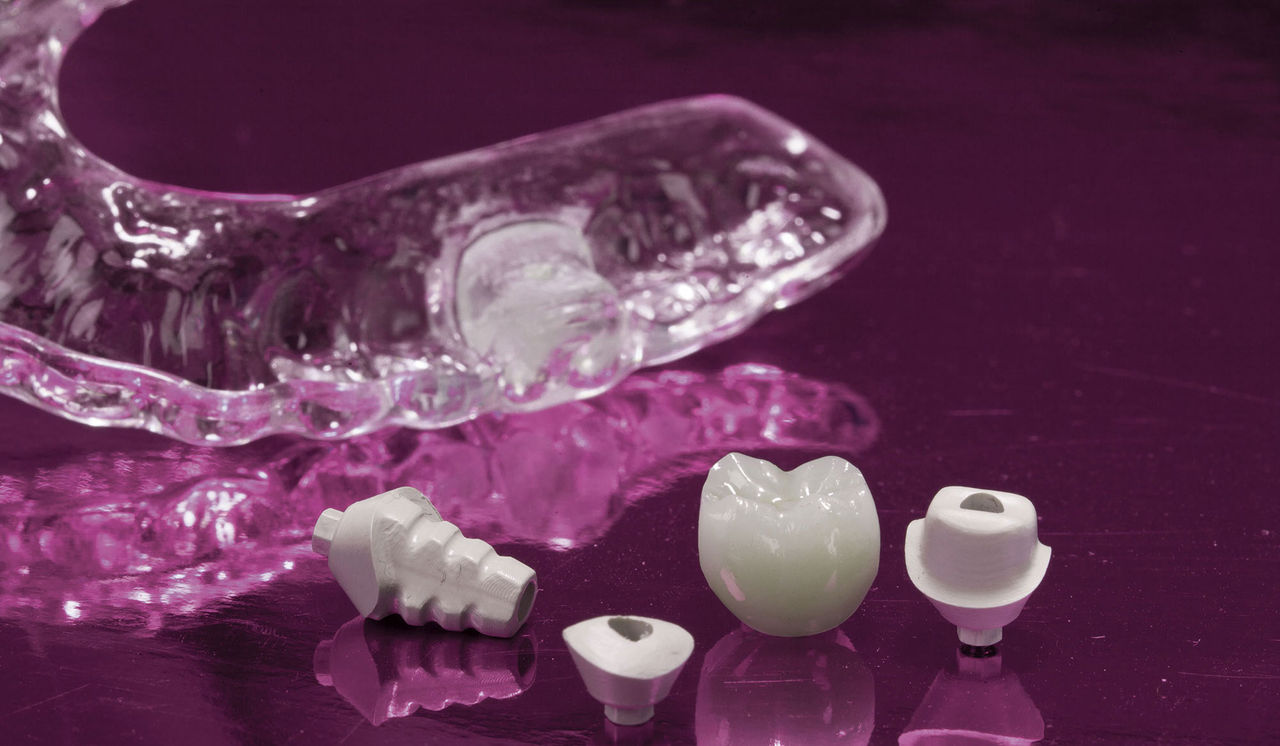 Place and Restore Dental Implants Economically