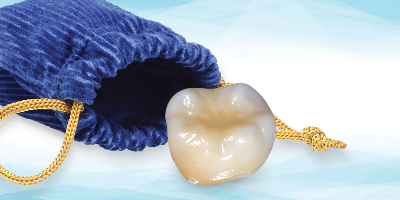 Tooth in a Bag: Same-Day Monolithic Zirconia Crown