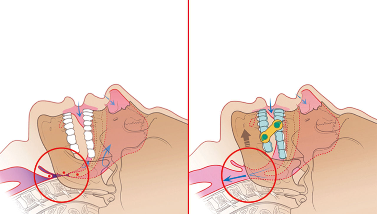 Dental Sleep Medicine: Treating Patients with Sleep-Related Disordered Breathing Hero