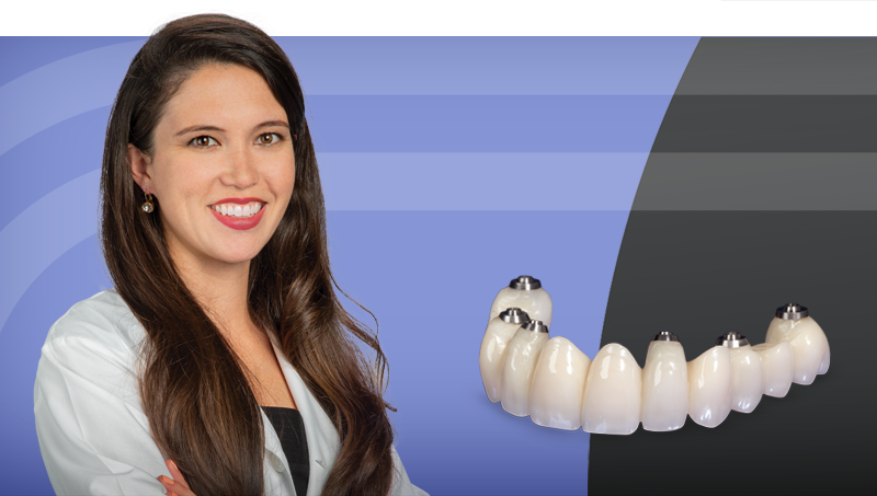4 Ways to Provisionalize Dental Implants