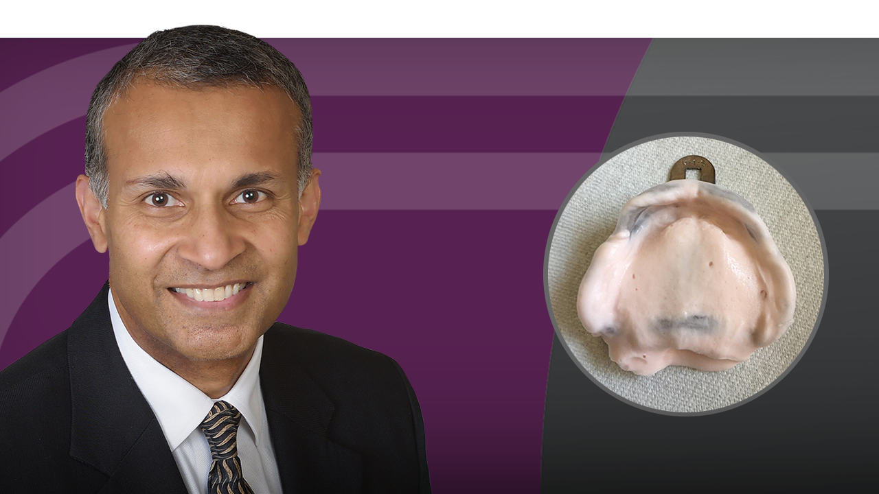 Mastering the Single-Tooth Implant hero image