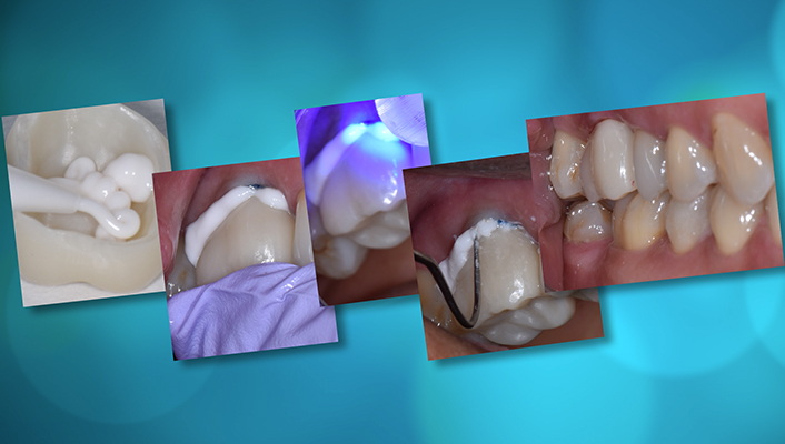 CEMENTATION: Tips, tricks, and trends for success