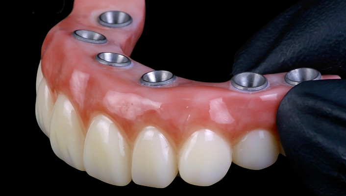 Dental Photography