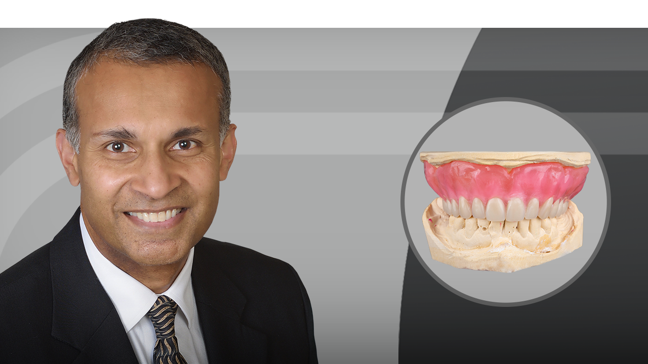 Mastering the Single-Tooth Implant hero image