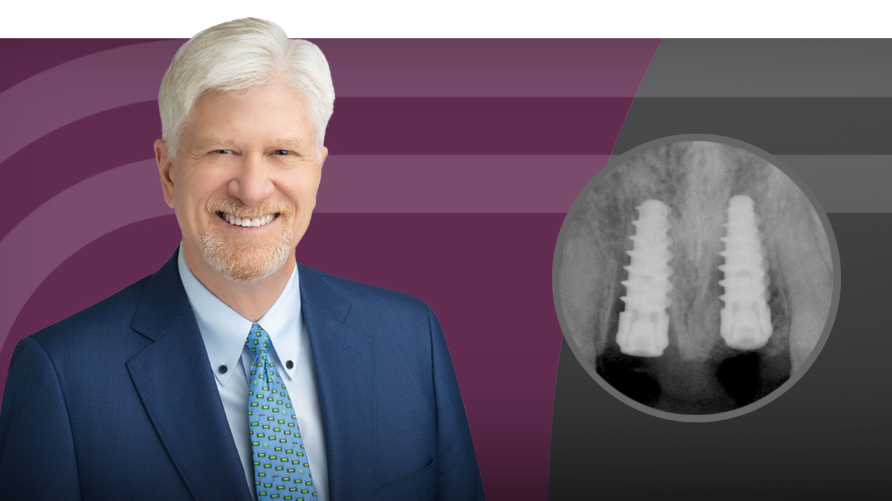 Implant Esthetics: From Extraction to Final Restoration Part 2