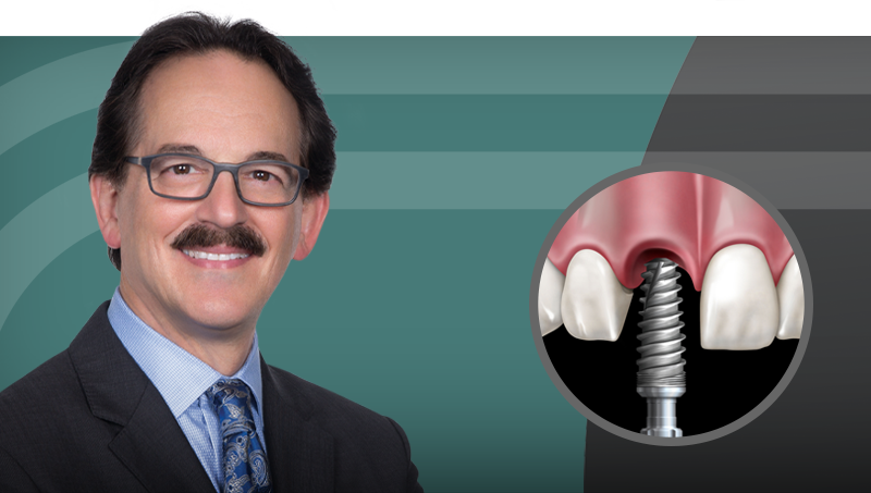 Mastering the Single-Tooth Implant hero image