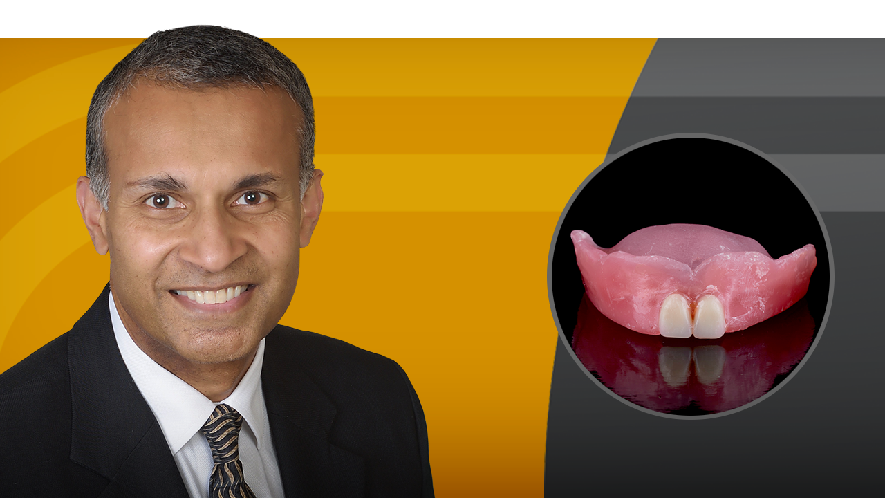 Mastering the Single-Tooth Implant hero image