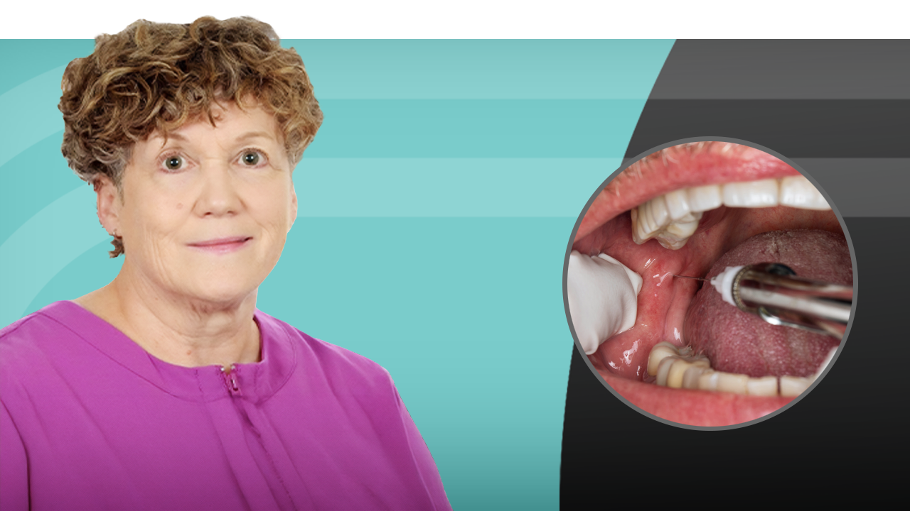 Success with Local Anesthesia: Mandibular Arch Techniques