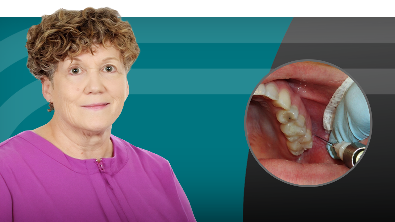 Success with Local Anesthesia: Maxillary Arch Techniques
