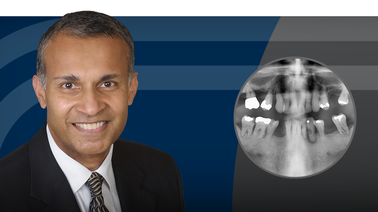 Mastering the Single-Tooth Implant hero image