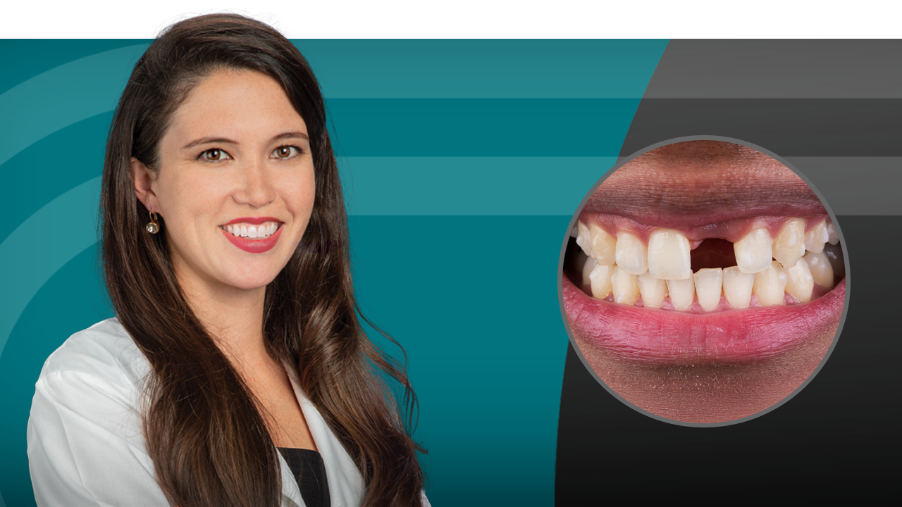 Treatment Planning for Single Unit Implant Placement