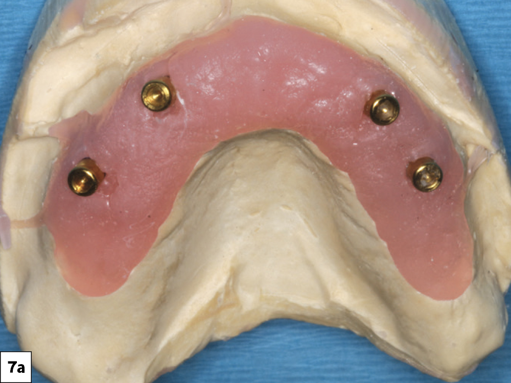 Figure 7a: soft-tissue model