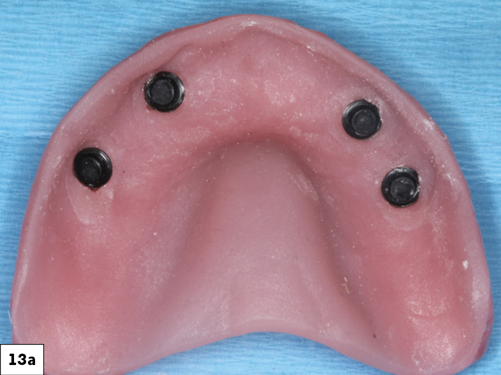 Figure 13a: black processing Locator attachments in its metal housings