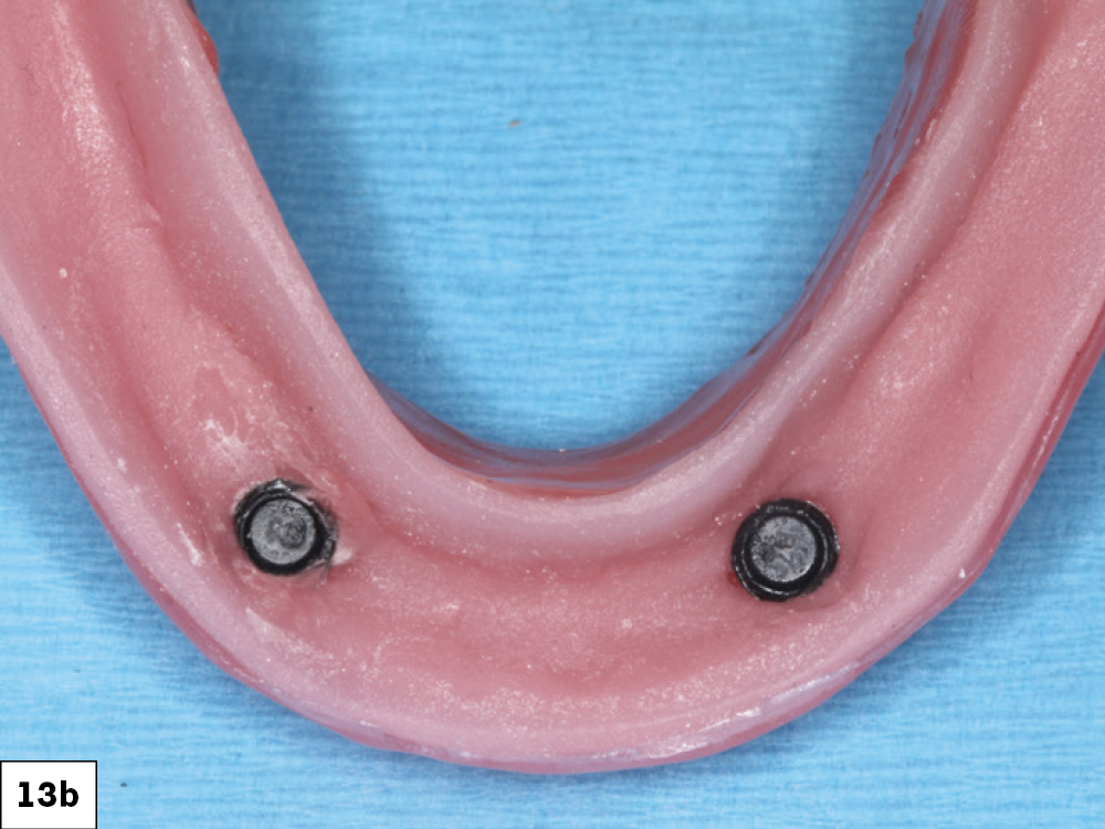 Figure 13b: black processing Locator attachments in its metal housings