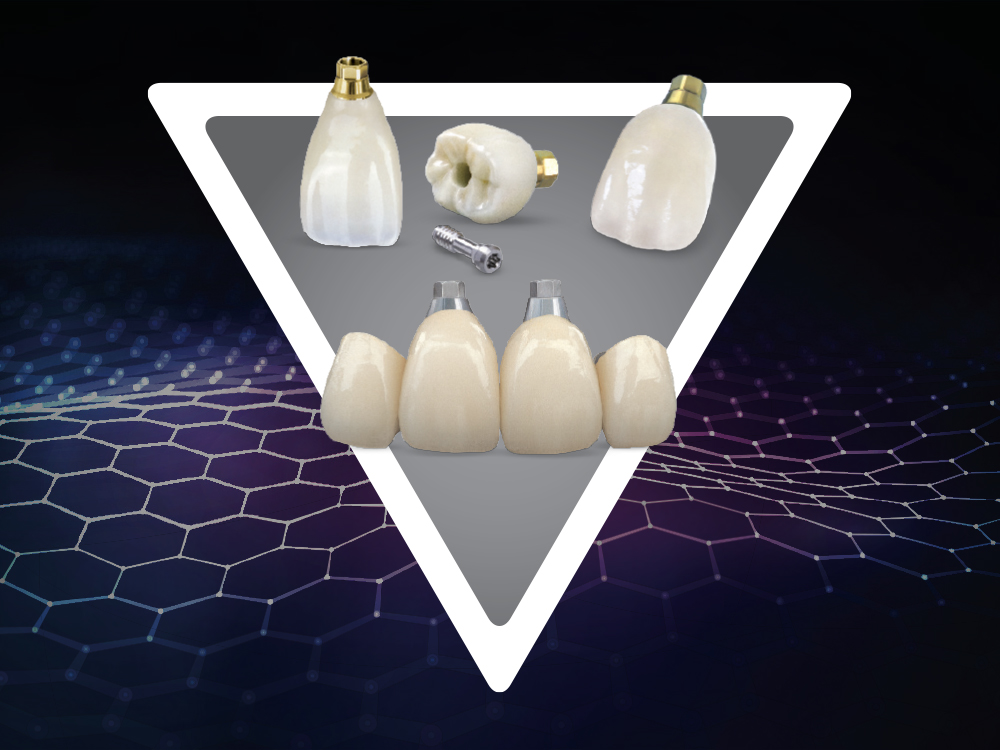 Product Spotlight: Screw-Retained Crowns