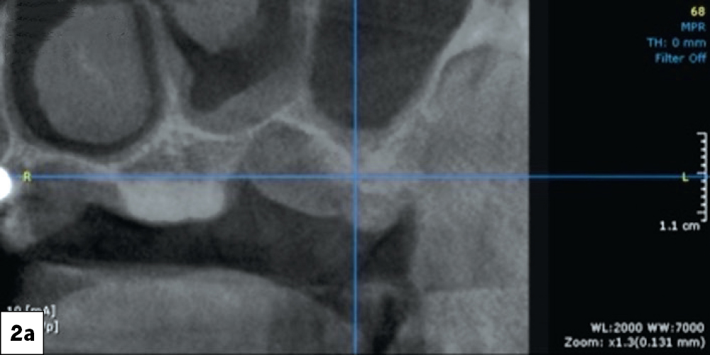 Figure 2a: CBCT scans