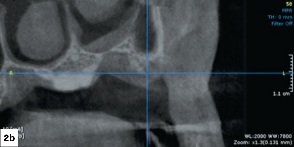 Figure 2b: CBCT scans