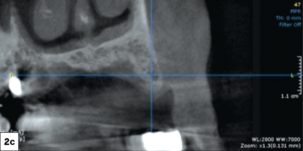 Figure 2c: CBCT scans