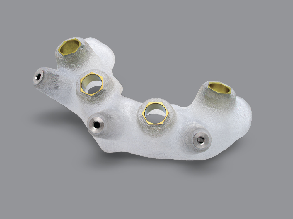 BONE-SUPPORTED