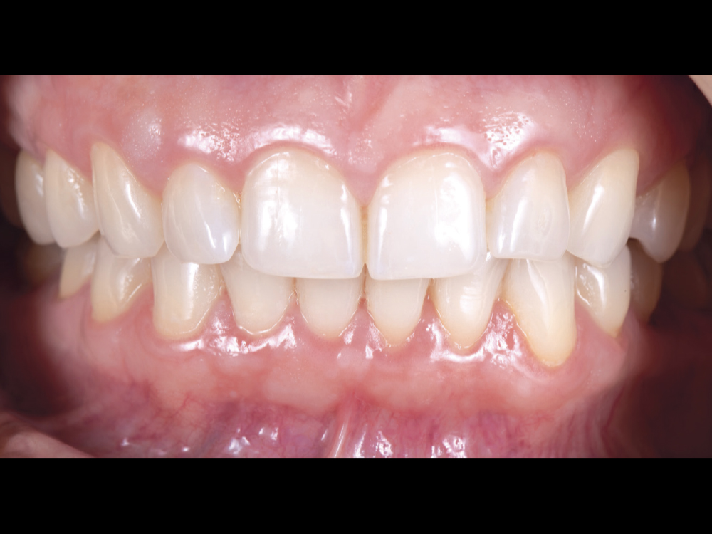 Upon first glance, the soft tissue and the teeth look acceptable.