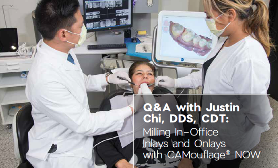 Chairside Magazine V12I3 Article Q&A with Justin Chi, DDS, CDT: Milling In-Office Inlays and Onlays with CAMouflage® NOW