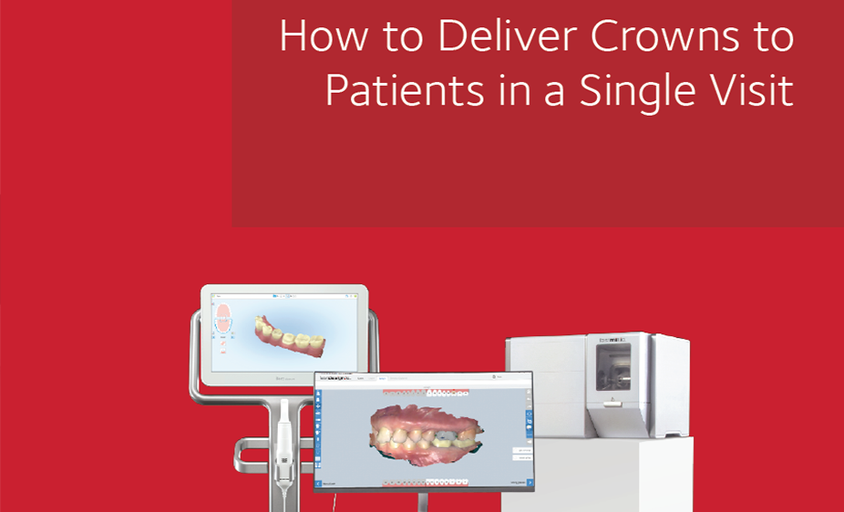 ADA News E-Book How to Deliver Crowns to Patients in a Single Visit